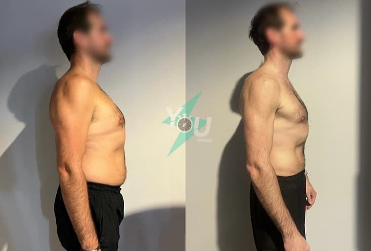 FLORENT avant / après