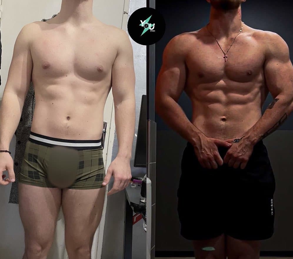 MATHYS avant / après